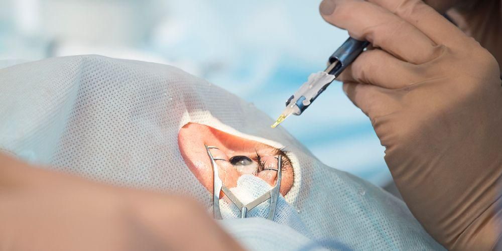 Apa Itu LASIK Mata?